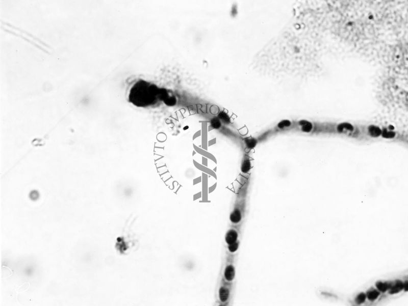 Nuclei di Penicillium Chrysogenum in cultura sommersa ingrandimento n. 1900