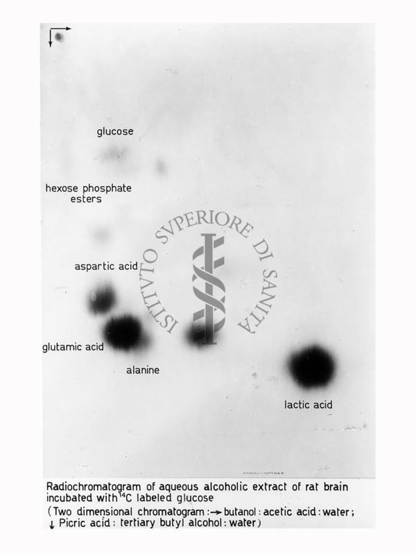 Riproduzione da radiografia estratto di cervello