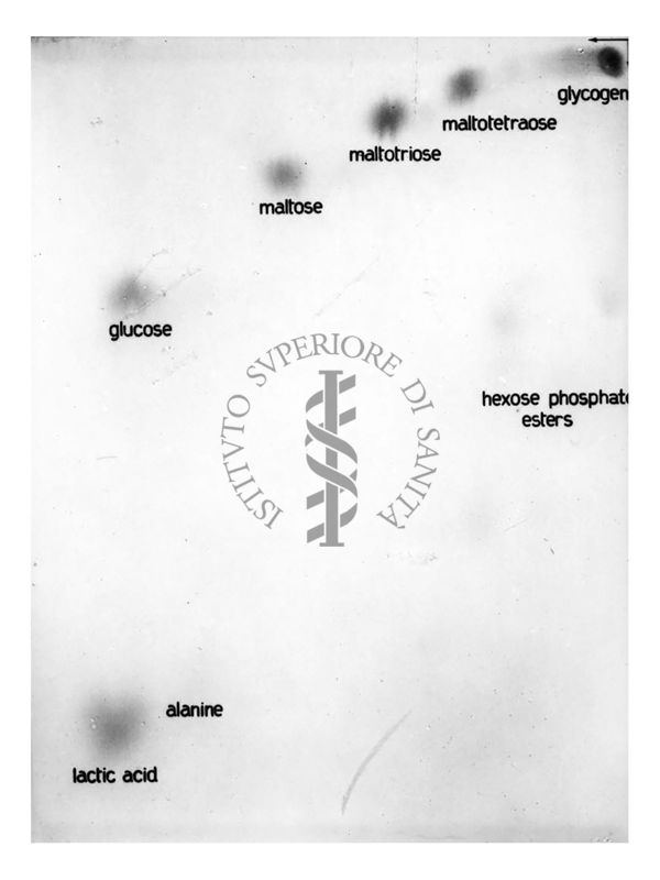 Riproduzione da radiografia estratto di diaframma