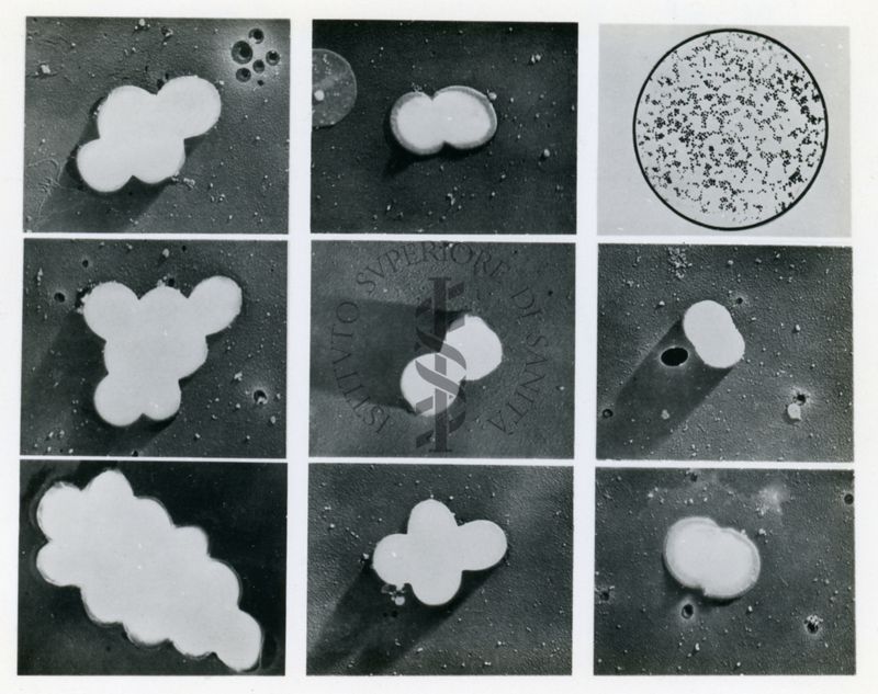 Vari aspetti della divisione cellulare di stafilococchi osservati al microscopio elettronico dopo preparazione con la tecnica dell'ombreggiatura