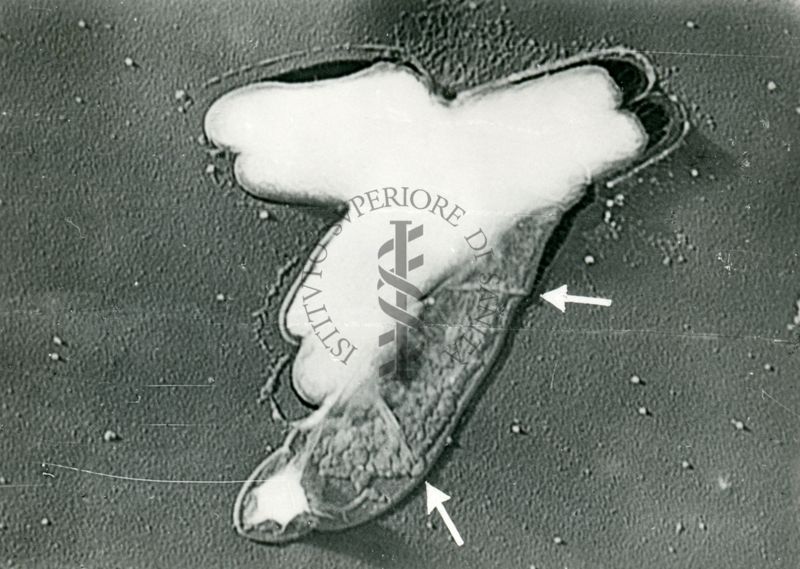 Mycobacterium tuberculosis