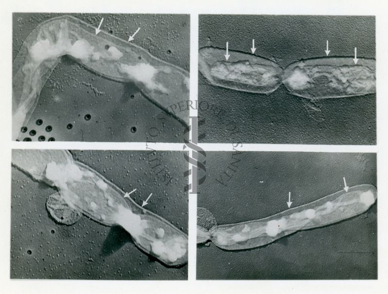 Bacillus anthracis, ceppo Zolla