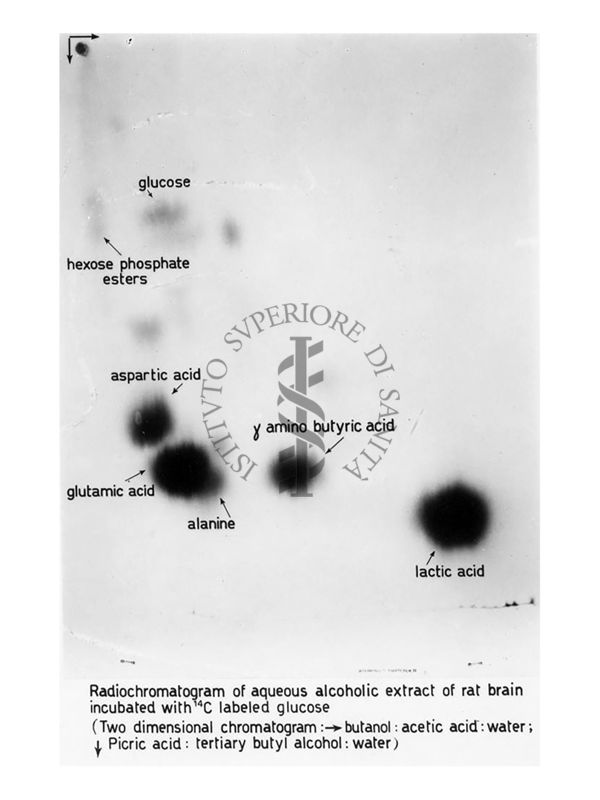 Cromatografia di estratto radioattivi di cervello di ratto