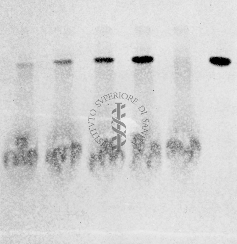 Gel cromatografico