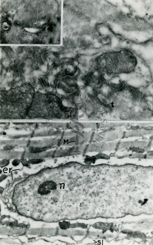 Particolare di una fibra muscolare (fibrocellula o miocita) in cui è ben visibile il nucleo allungato; e forte ingrandimento del miocita