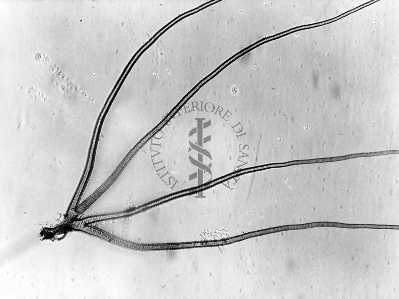 Foto del filamento respiratorio pupale di dittero Simulide sp.