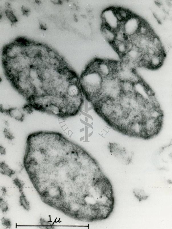 Sezione di cellule batteriche di forma ovoidale (bacilli). In alto a destra si può osservare un avanzato processo di divisione