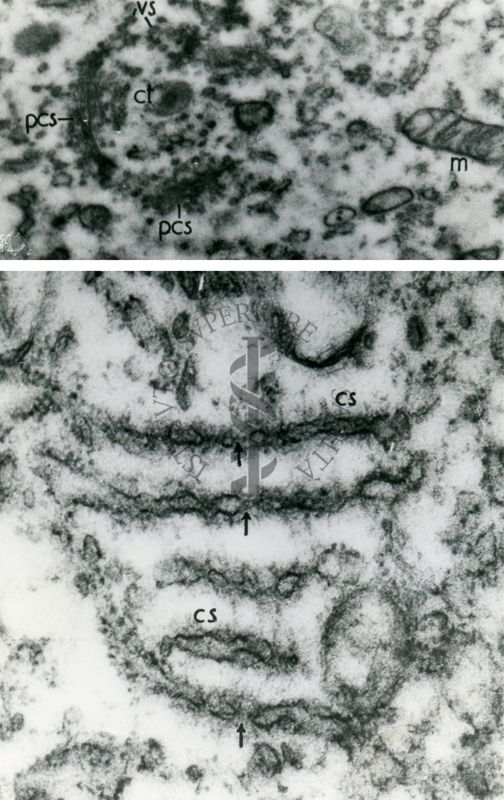 Porzioni di citoplasma contenenti un particolare arrangiamento del reticolo endoplasmatico (lamelle annullate), caratteristico delle cellule germinali e tumorali