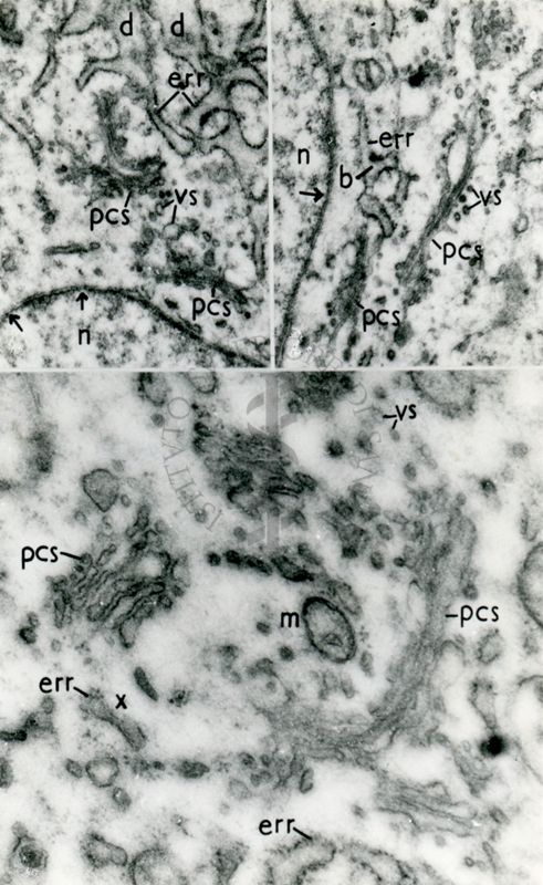 Diversi aspetti dell'apparato vescicolare della cellula. Sono visibili porzioni dell'apparato del Golgi, del reticolo endoplasmatico e vescicole di trasporto