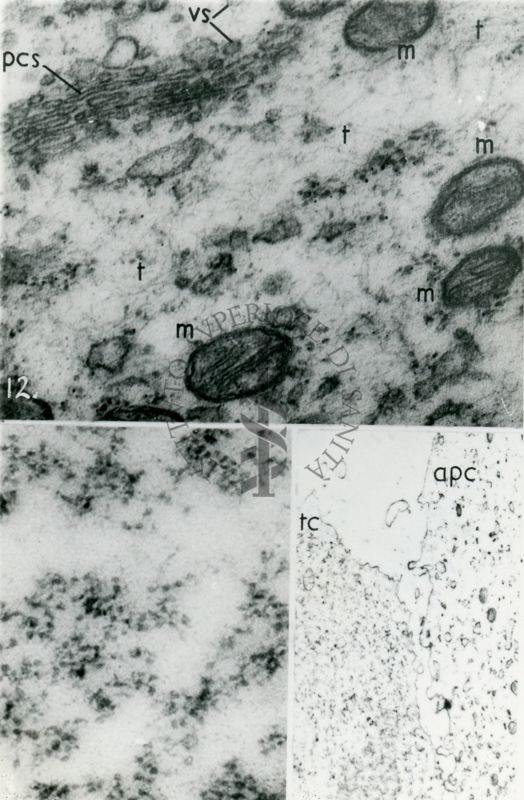 Particolari a forte ingrandimento del citoplasma di una cellula. Nella microfotografia in alto sono visibili l'apparato del Golgi ed alcuni mitocondri