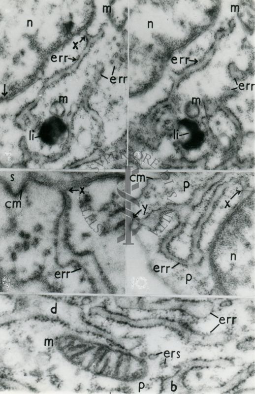 Dettagli del citoplasma cellulare in cui sono evidenziate porzioni del reticolo endoplasmatico rugoso (err)