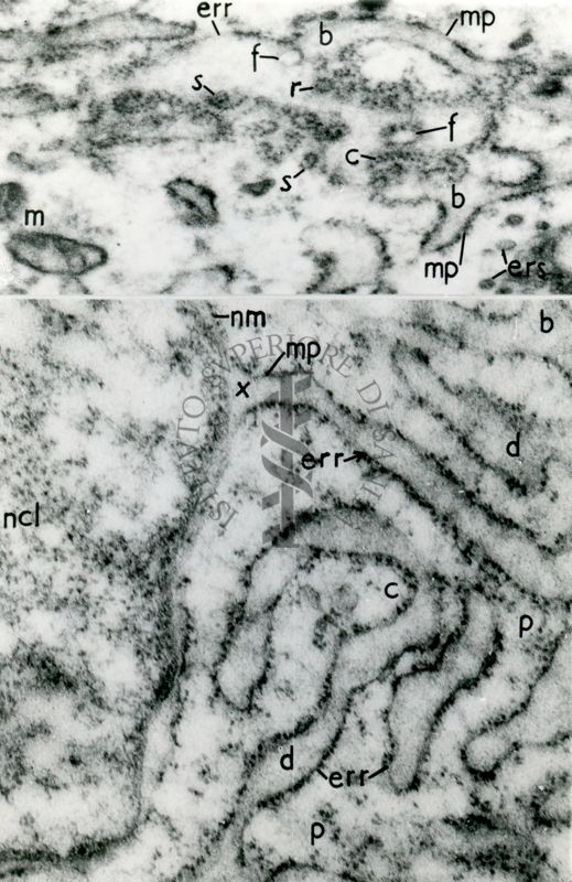 Particolari del reticolo endoplasmatico rugoso