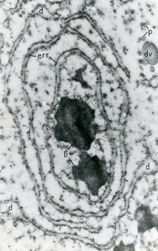 Reticolo endoplasmatico rugoso (err) che circonda due strutture irregolari elettrodense identificate come lisosomi (li)