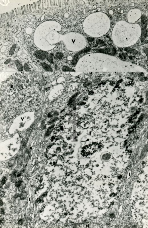 Sezione ultrasottile di un tessuto epiteliale caratterizzato dalla presenza di numerosi microvilli sulla superficie cellulare (orletto a spazzola). In questo campione le cellule epiteliali contengono numerosi vacuoli ed un grande nucleo