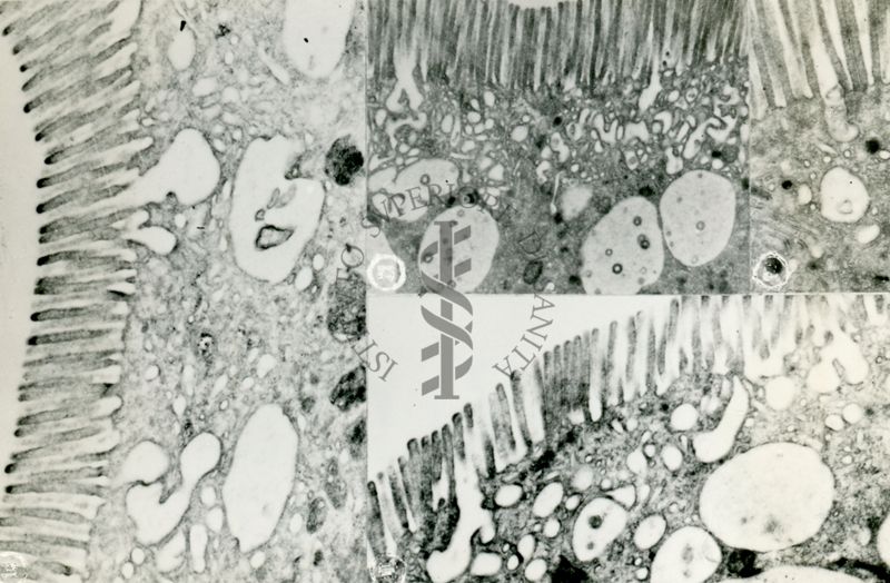 Diversi aspetti della superficie di cellule epiteliali contenenti numerosi e lunghi microvilli