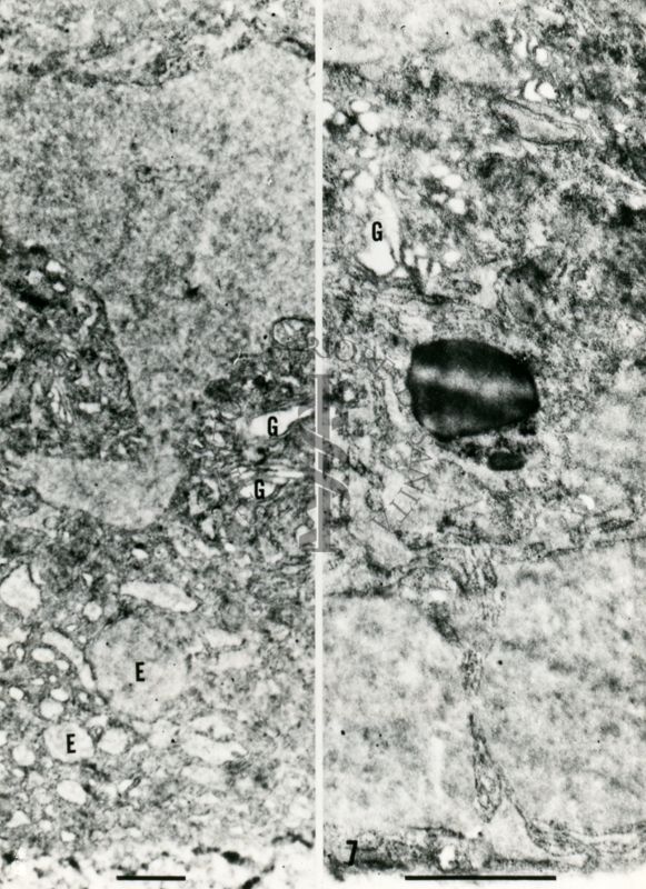 Porzioni di citoplasma fortemente vacuolizzato