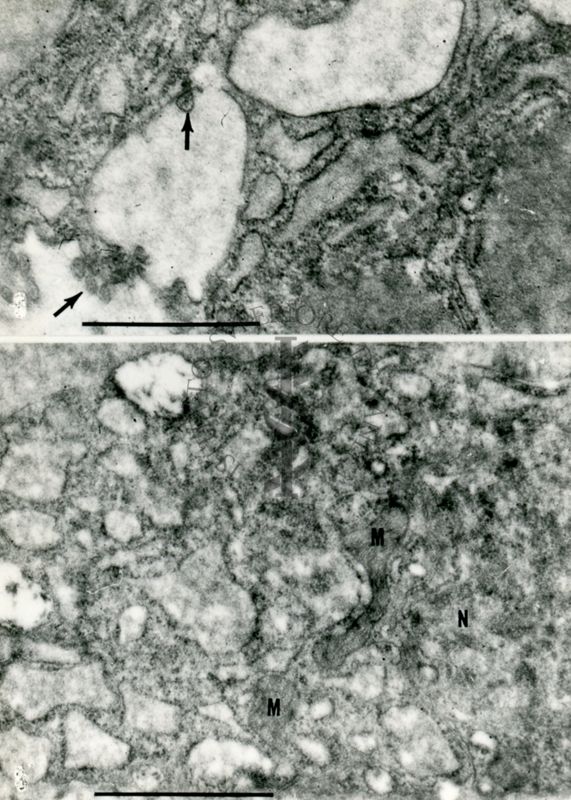 Porzioni di citoplasma fortemente vacuolizzato