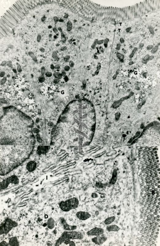 Due diverse sezioni di epitelio cilindrico semplice cigliato. Nella micrografia superiore sono visibili tre cellule epiteliali adiacenti