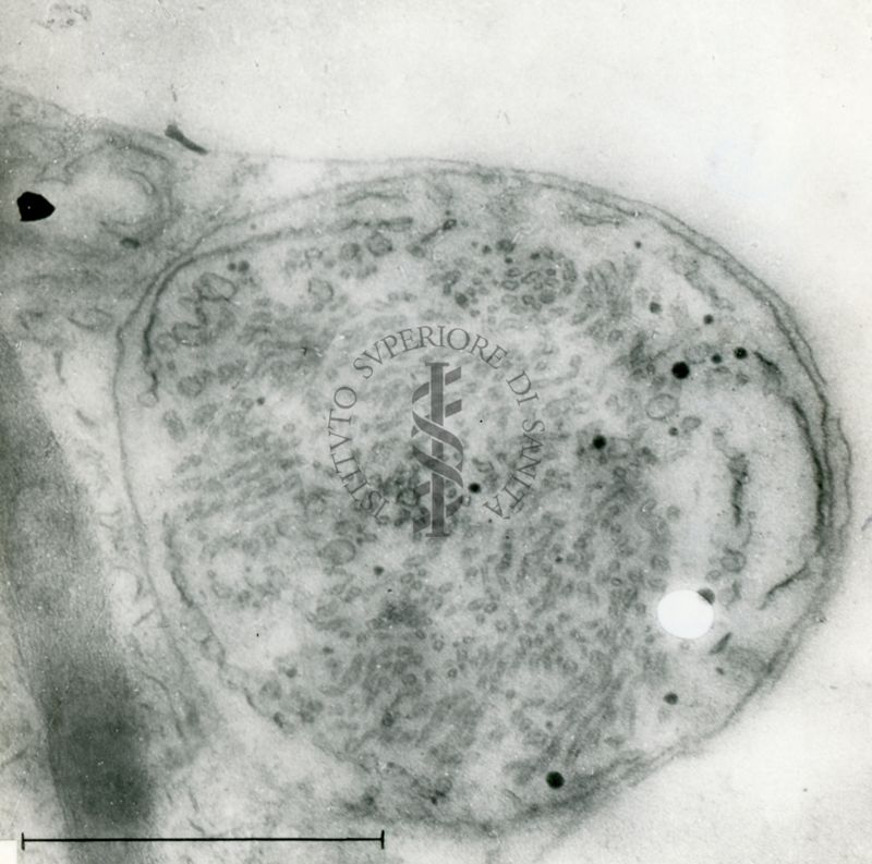 Particolare della sezione di un campione biologico che mostra una struttura, delimitata da una doppia membrana, rilasciata da una cellula microbica o vegetale (possibile spora)