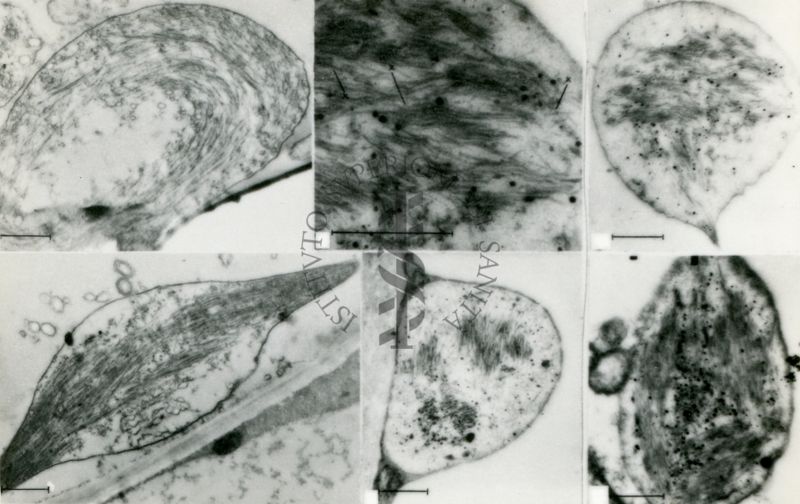 Immagini di strutture delimitate da membrana contenenti materiale di diversa natura