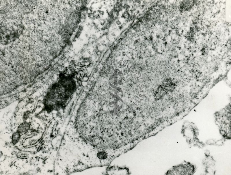 Sezione ultrasottile di una porzione di tessuto formato da cellule con nuclei molto ampi e scarso citoplasma