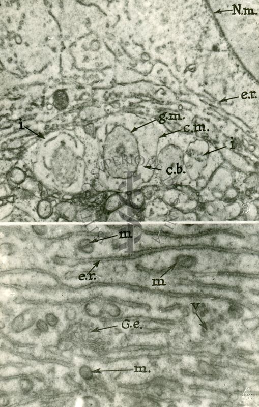 Particolare del citoplasma di una cellula contenete uno sviluppato reticolo endoplasmatico