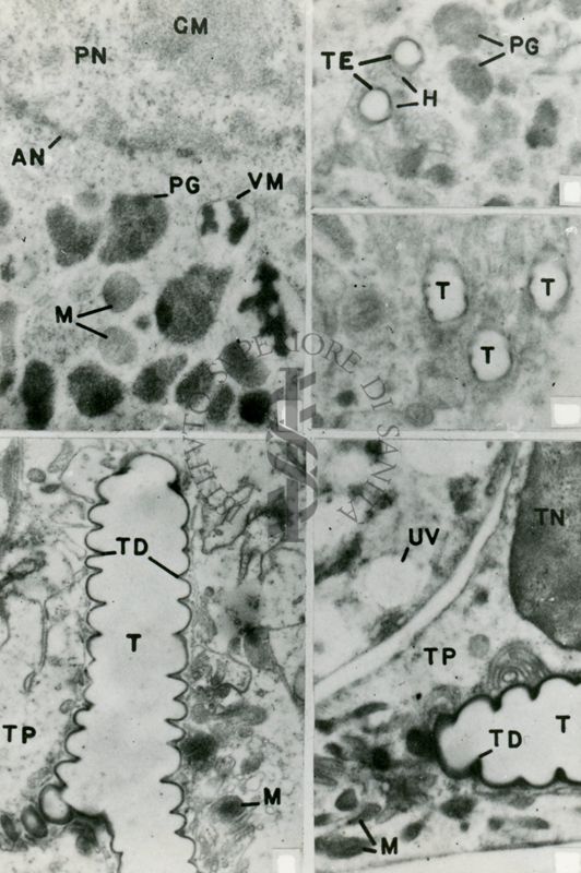 Particolare del sistema respiratorio di un insetto. Sono evidenziate le tracheole (T) in sezioni longitudinali (in basso) e trasversali (in alto)
