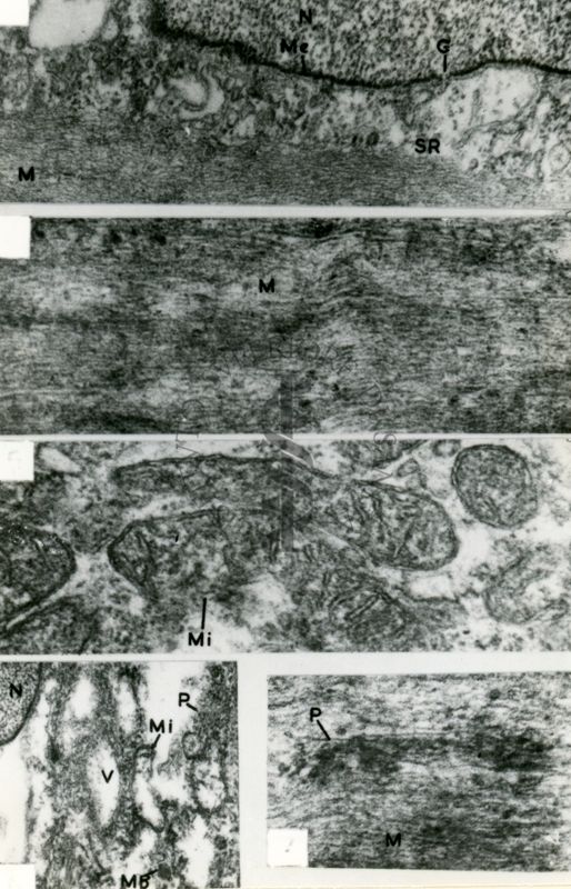 Composizione di micrografie elettroniche che mostra diverse strutture subcellulari, quali nucleo (N), fasci di microfilamenti (M), mitocondri (Mi), vacuoli (V)