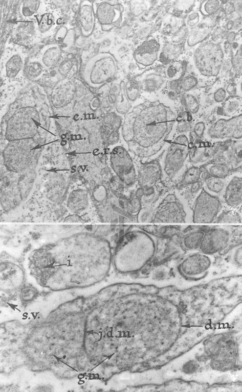 Particolari a forte ingrandimento di un campione biologico costituito da numerose e complesse strutture vescicolari delimitate da membrane