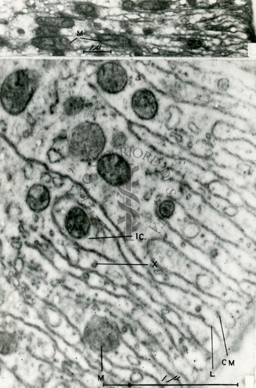 Particolare del citoplasma contenente numerosi mitocondri tondeggianti all'interno di un convoluto reticolo endoplasmatico