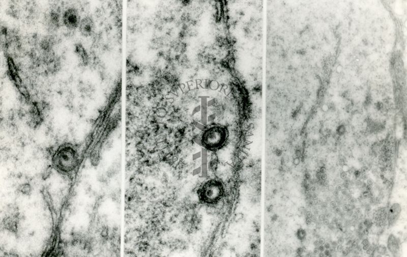 Forme intracellulari di virus erpetico. Le due particelle in alto a sinistra sono forme immature prive di "envelope". La particella sottostante sta acquisendo l'envelope usando le membrane citoplasmatiche mentre le due particelle dell'immagine centrale sono forme complete