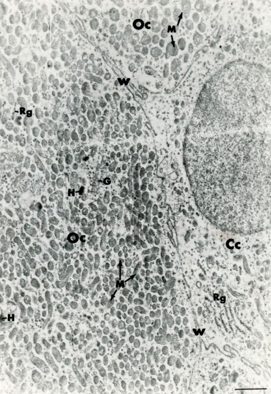 Particolare di un tessuto che mostra porzioni di tre cellule adiacenti. La cellula di destra mostra un nucleo ben preservato e citoplasma rarefatto mentre le porzioni delle altre due cellule mostrano citoplasmi particolarmente ricchi di mitocondri ed altri organuli citoplasmatici