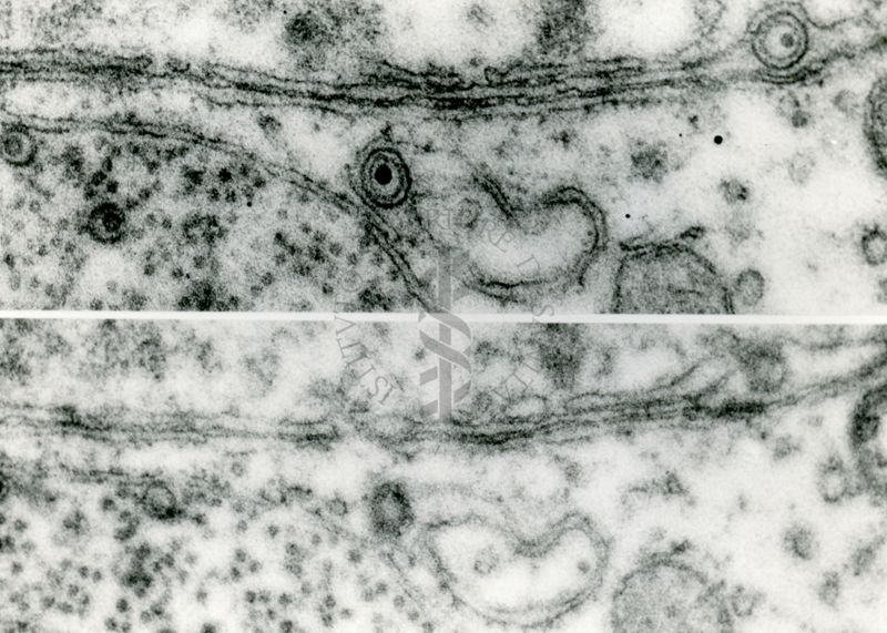 Forme intracellulari di virus erpetico. Nell'immagine superiore le due particelle a sinistra sono forme immature prive di "envelope". Le altre due particelle sono forme complete che hanno costituito l'envelope usando le membrane citoplasmatiche