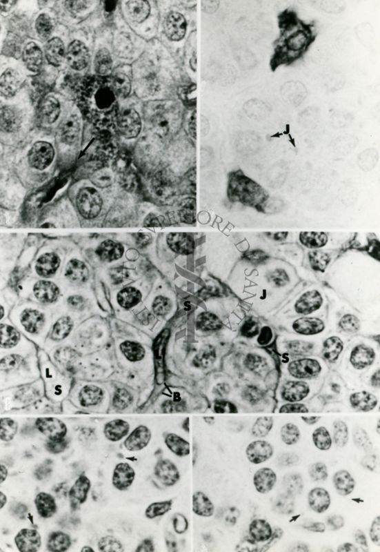 Composizione di diverse micrografie elettroniche effettuate a basso ingrandimento su un campione biologico. Sono ben visibili i nuclei delle cellule