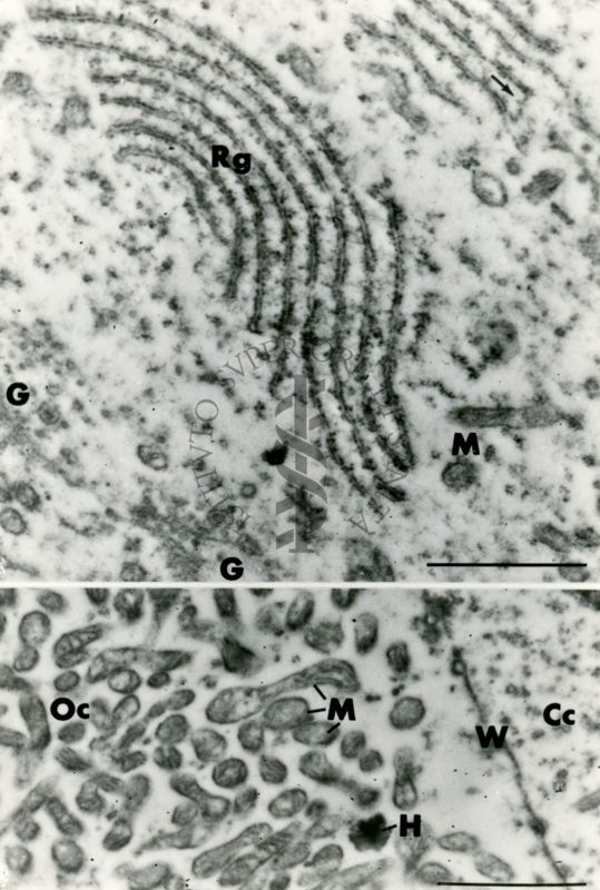 Particolari del citoplasma di una cellula. Sono visibili il reticolo endoplasmatico (in alto) e numerosi mitocondri e vescicole (in basso)