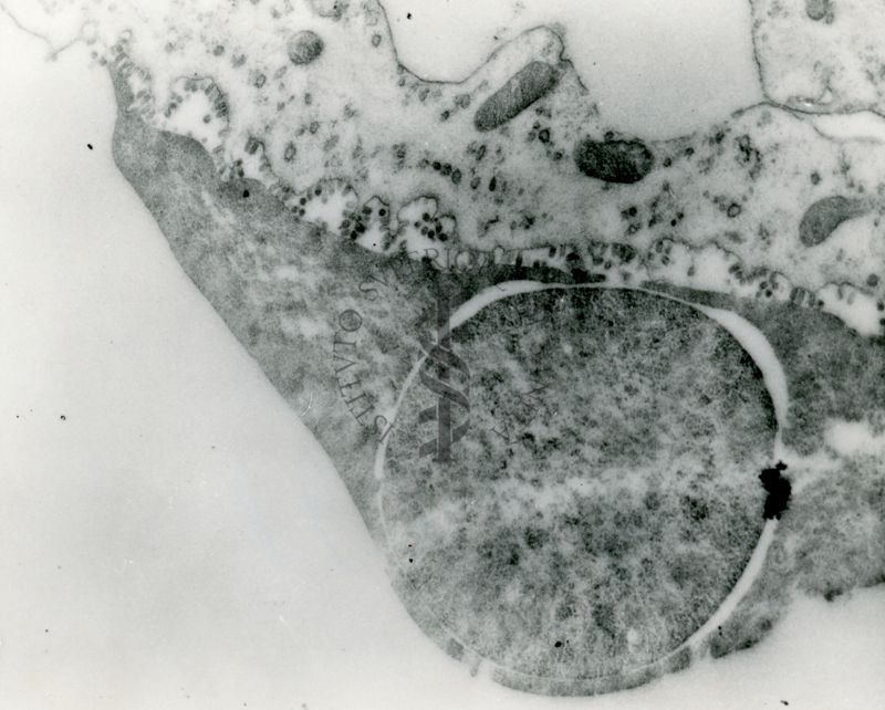 Particolare di una sezione di membrana corio-allantoidea di embrione di pollo. Numerose particelle di virus dell'influenza sono presenti nello spazio tra la membrana e l'adiacente emazia