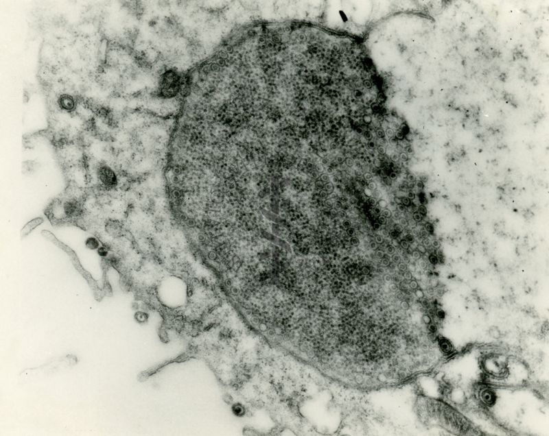 Sezione di cellula infettata con herpes virus. Numerose particelle virali immature sono visibili all'interno del nucleo