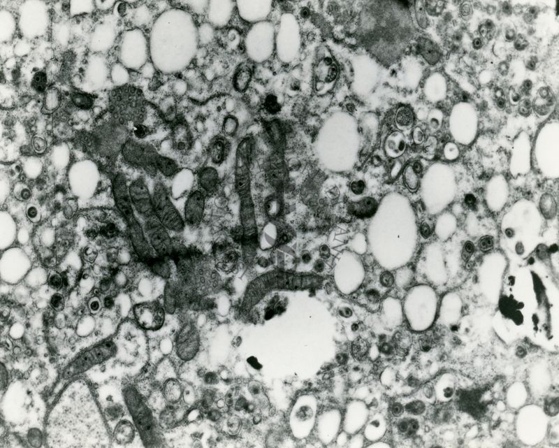 Particolare del citoplasma di una cellula in cui i mitocondri appaiono ben preservati ma è visibile una marcata vacuolizzazione probabilmente dovuta alla presenza di piccole strutture sferiche similvirali