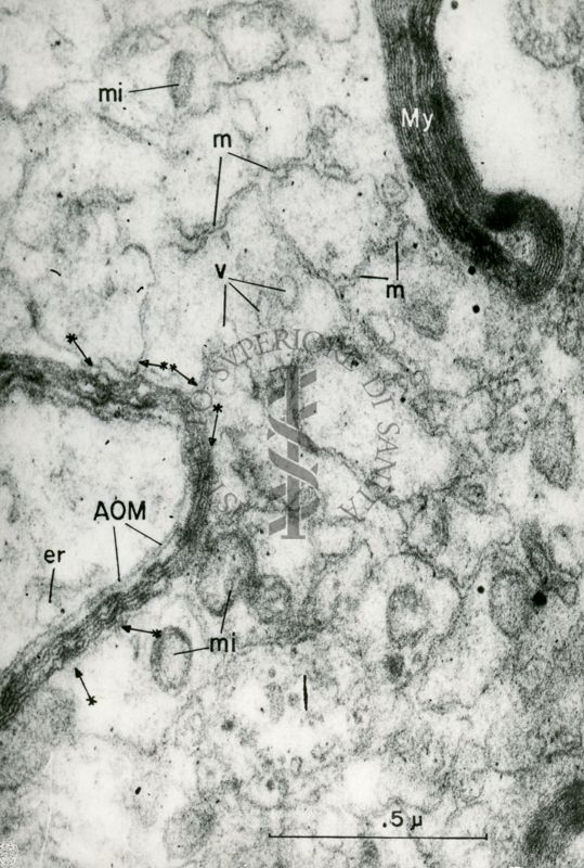 Porzione di citoplasma cellulare in cui sono visibili mitocondri (mi), vacuoli (v), membrane del reticolo (m) ed una figura mielinica (My)