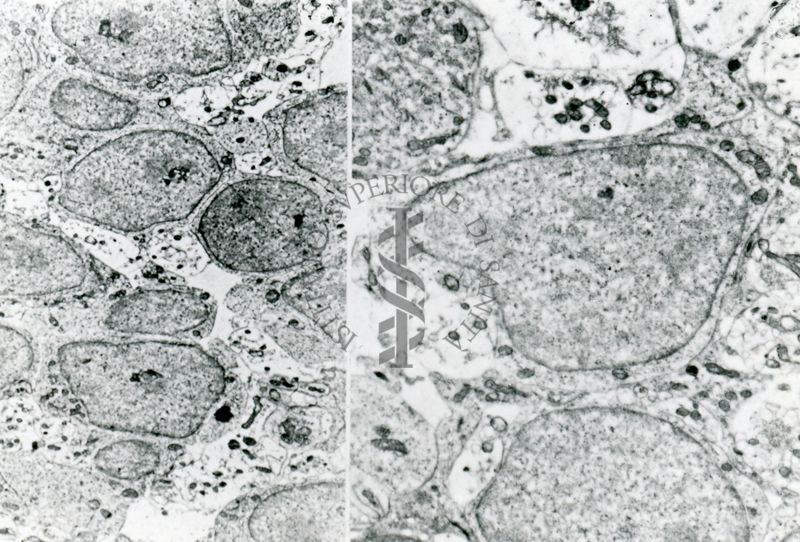 Sezione di tessuto o di monostrato di cellule in coltura osservato a due diversi ingrandimenti. Le cellule che lo compongono hanno grandi nuclei e scarso citoplasma