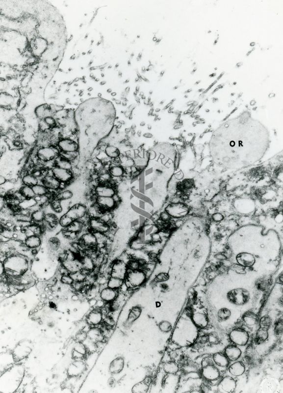 Immagine suggestiva di un epitelio ghiandolare. Il basso ingrandimento non permette di chiarire la natura delle piccole strutture che fuoriescono dalle cellule (particelle similvirali o microvirali)