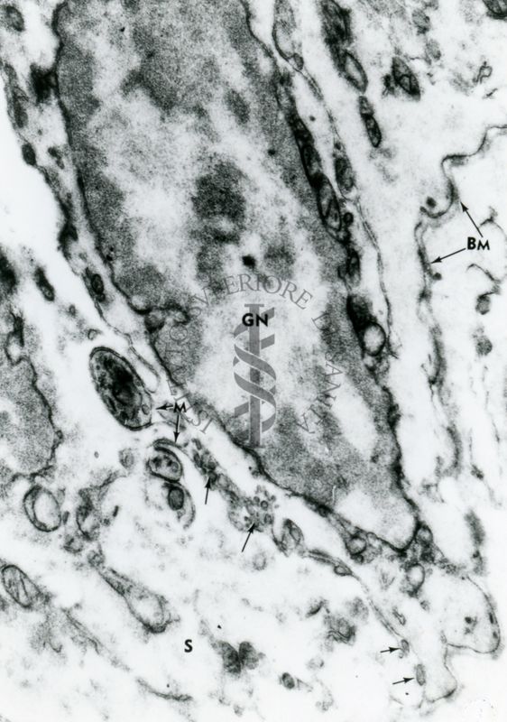 Particolare di un tessuto in cui sono evidenziate le giunzioni (BM) tra cellule adiacenti