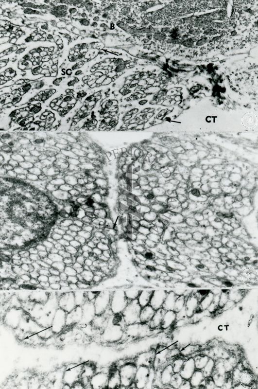 Particolare ad ingrandimento crescente di una ghiandola sebacea. Le cellule mostrano il citoplasma pieno di vacuoli contenenti il materiale di secrezione