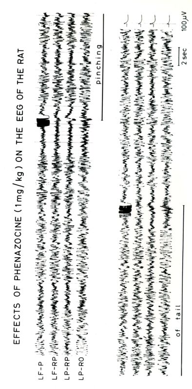 Tracciati elettroencefalografici