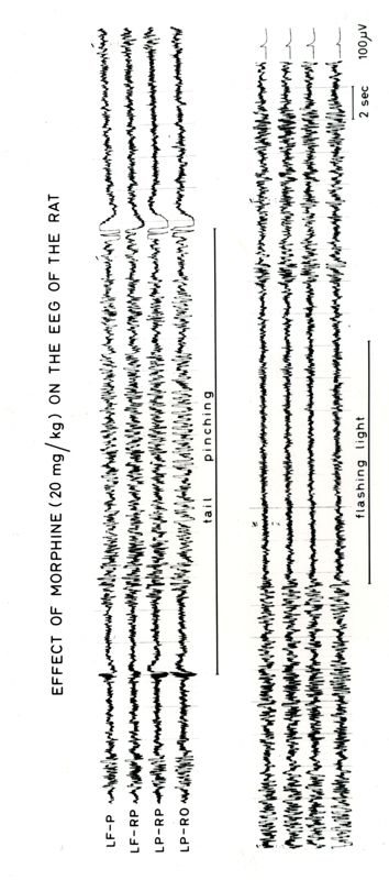 Tracciati elettroencefalografici