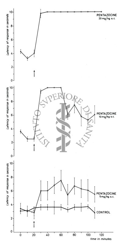 Tracciati elettroencefalografici