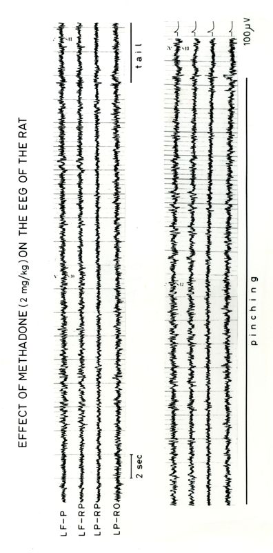 Tracciati elettroencefalografici