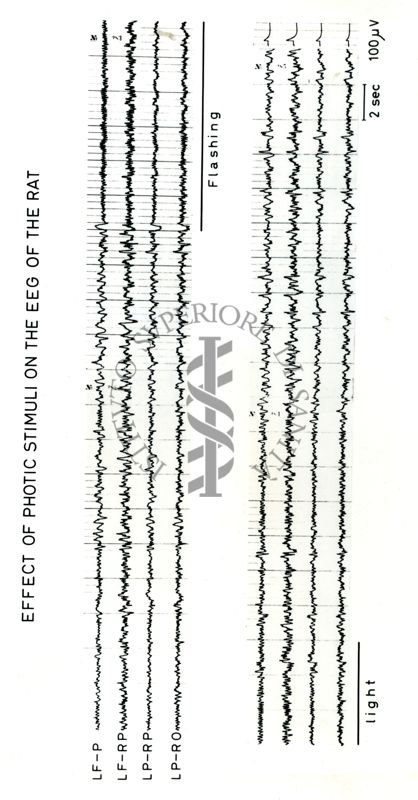 Tracciati elettroencefalografici