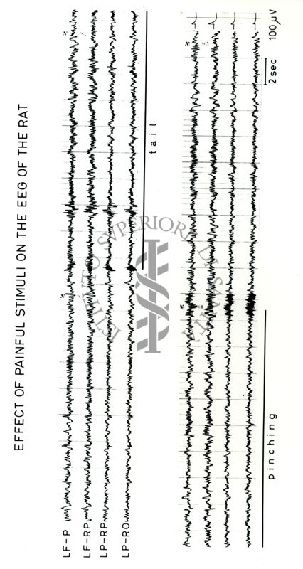 Tracciati elettroencefalografici