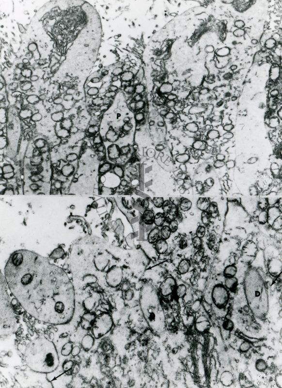 Particolare di cellule con citoplasma fortemente vacuolizzato